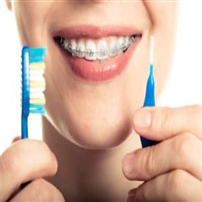 نظافة الفم اثناء علاج تقويم الاسنان