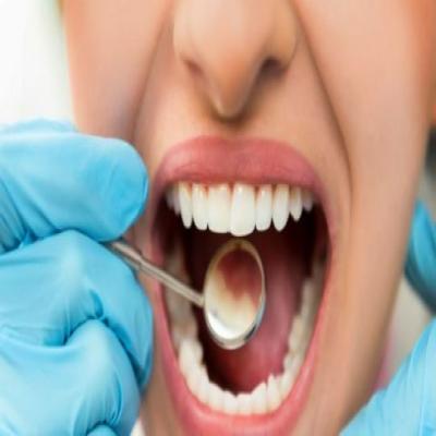 طرق الوقاية من تسوس الأسنان